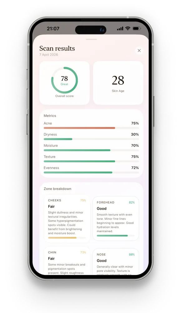 Glō skin analysis results: hydration, acne, texture, evenness and skin age scores per face zone